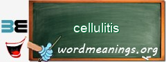 WordMeaning blackboard for cellulitis